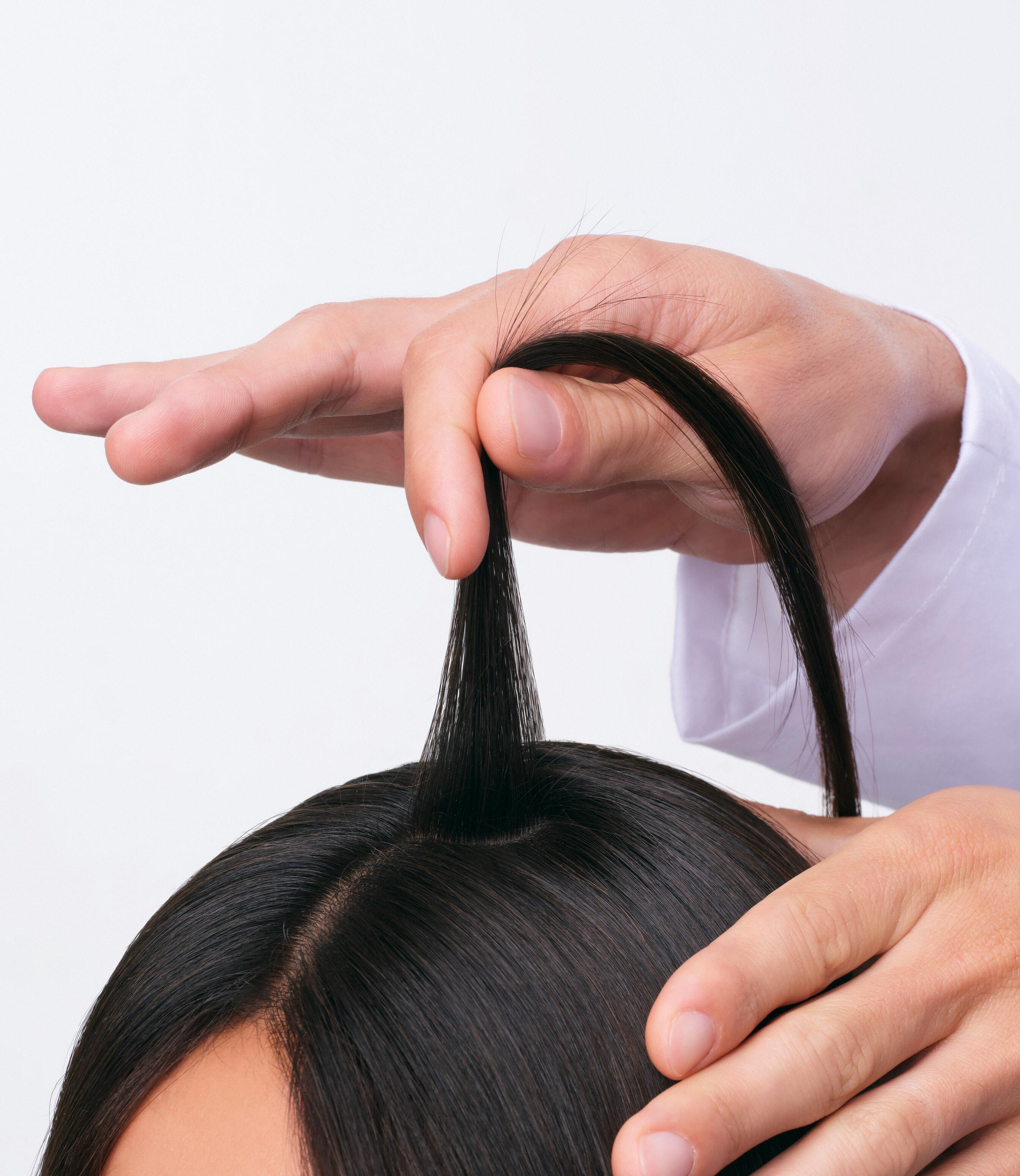 DU_ANAPHASE_HCP gesture_Pathology_Reactional Hair Loss_4x5